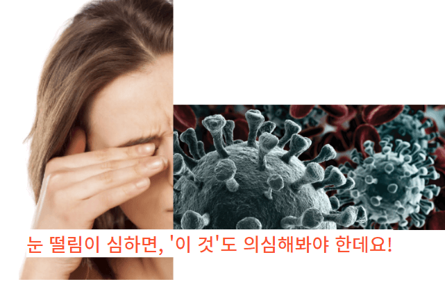  눈떨림 증상, 나만 경험하는 것 아니죠?