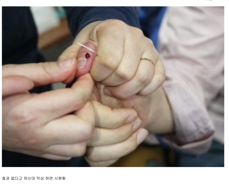  손을 따면 체한게 잘 내려가는 이유