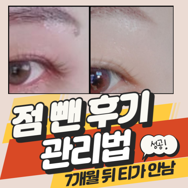 점뺀후 흉터관리 재생연고 써지엔젤 플러스