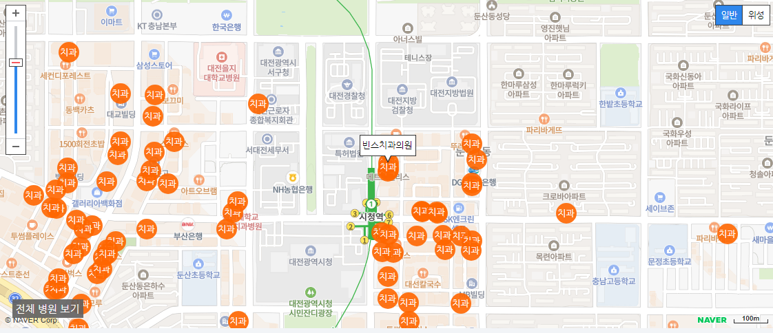 대전 야간진료 치과 후기 좋은 치과 빈스치과의원