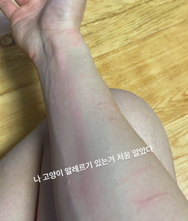  고양이 알레르기 증상과 증상 완화방법은 뭐가 있을까?