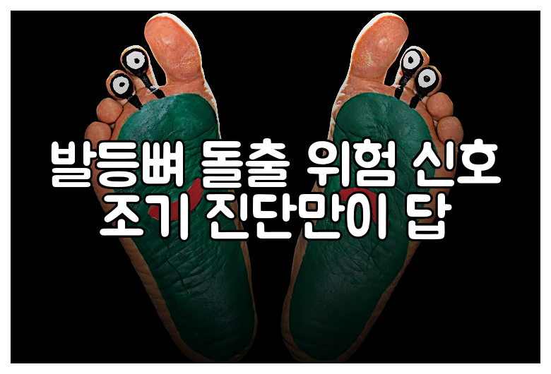 발등뼈 돌출 위험 신호 조기 진단만이 답