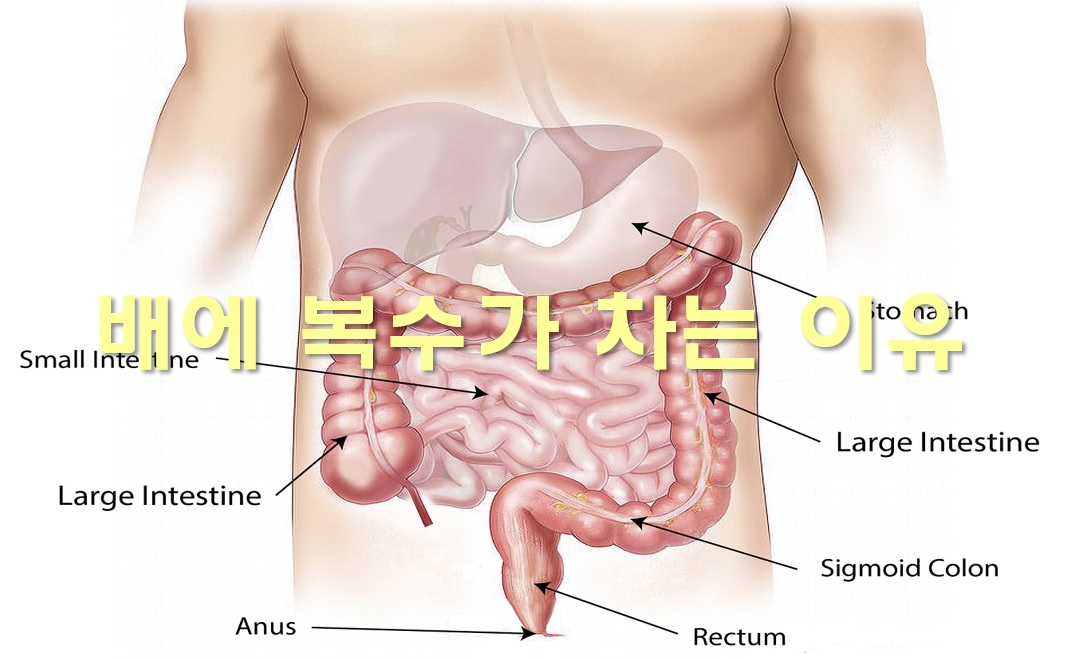  배에 복수 차는 증세와 배에 복수가 차는 이유