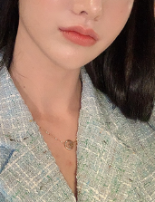  입꼬리 수술 후기, 솔직히 '이거' 모르면 후회합니다ㅠ