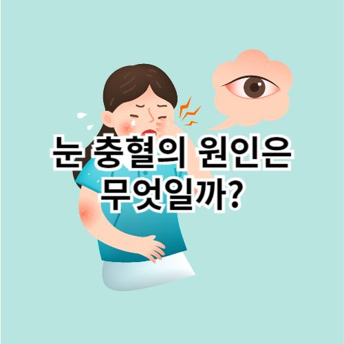 눈-충혈의-원인은-무엇일까