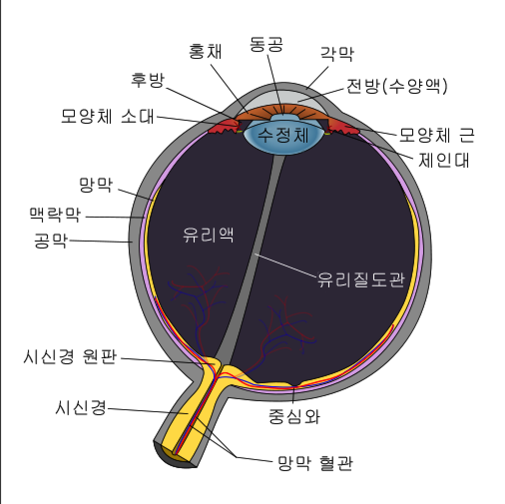 백내장증상