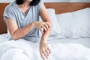가려움