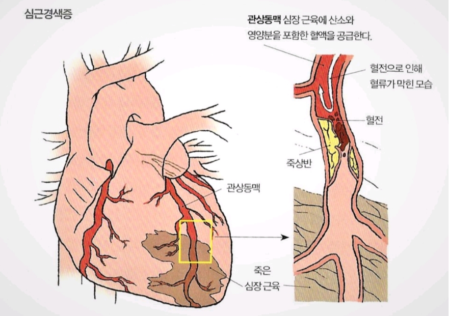 심장구조