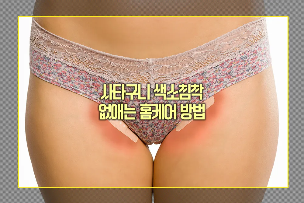 사타구니 색소침착 없애는 홈케어 방법