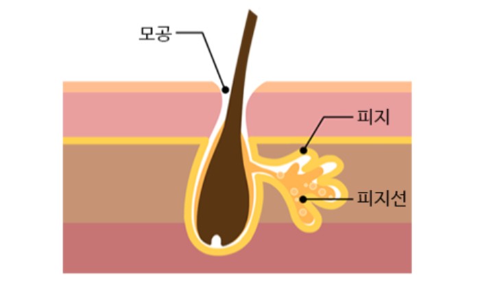 피지선 사진