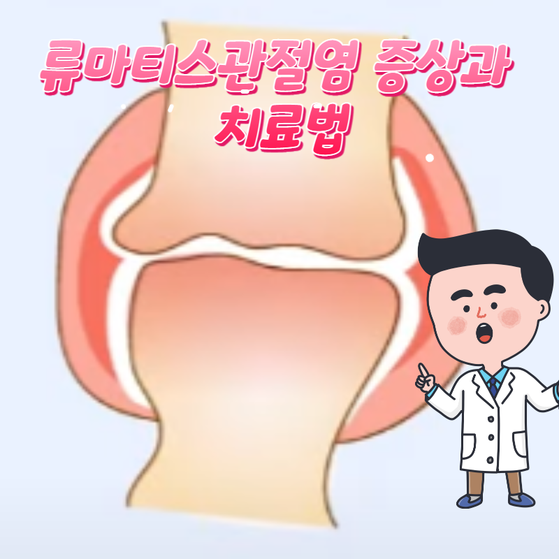  류마티스관절염 증상과 치료법