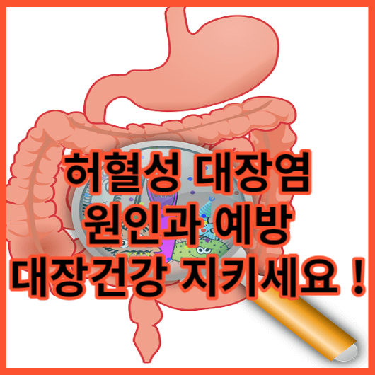  허혈성 대장염 원인과 허혈성 대장염 증상 예방법과 치료방법 알아보기. 대장건강의 중요성