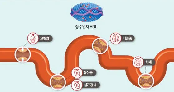 혈소판수치가 높으면