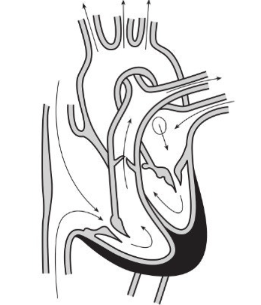솔잎 효능 31