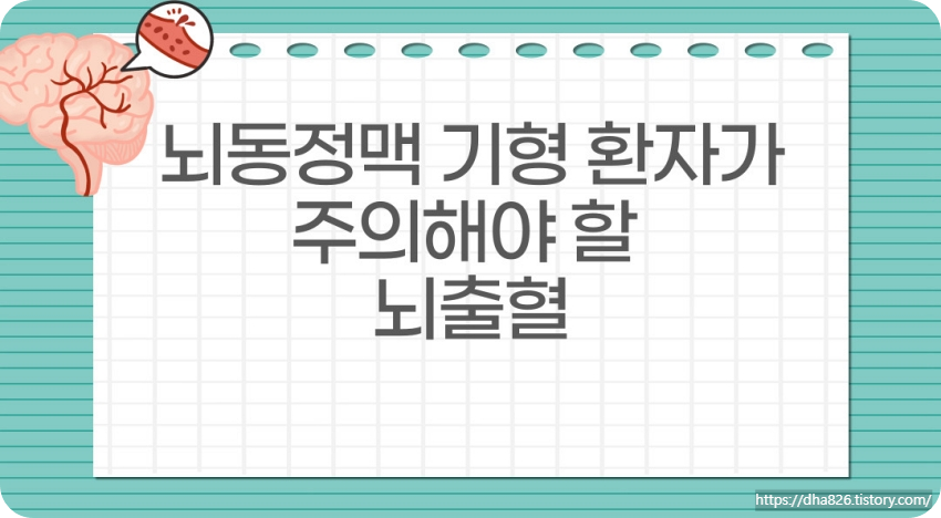 뇌동정맥 기형 환자가 주의해야 할 뇌출혈