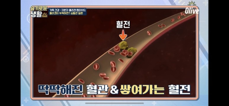  슬기로운생활/ 건강생활 /저분자 콜라겐 벱타이드 / 혈관관리 / 피부관리 도움을 주는 콜라겐
