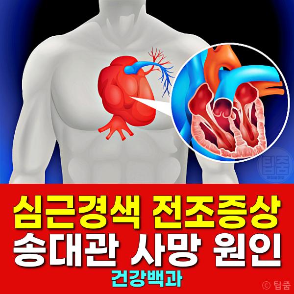 심근경색 전조증상 송대관 사망 원인