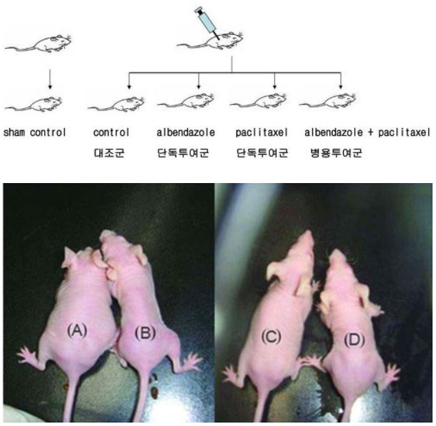 알벤다졸 항암효과