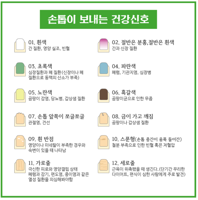 손톱 울퉁불퉁