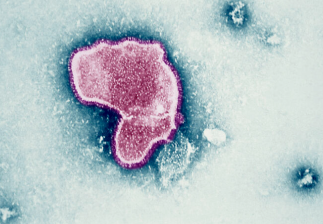 RSV세포에 대한 세포단면 촬영 사진