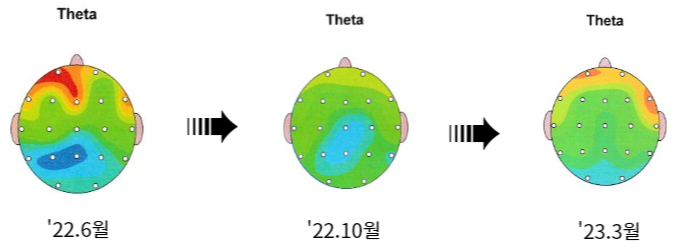 세타파 뇌파