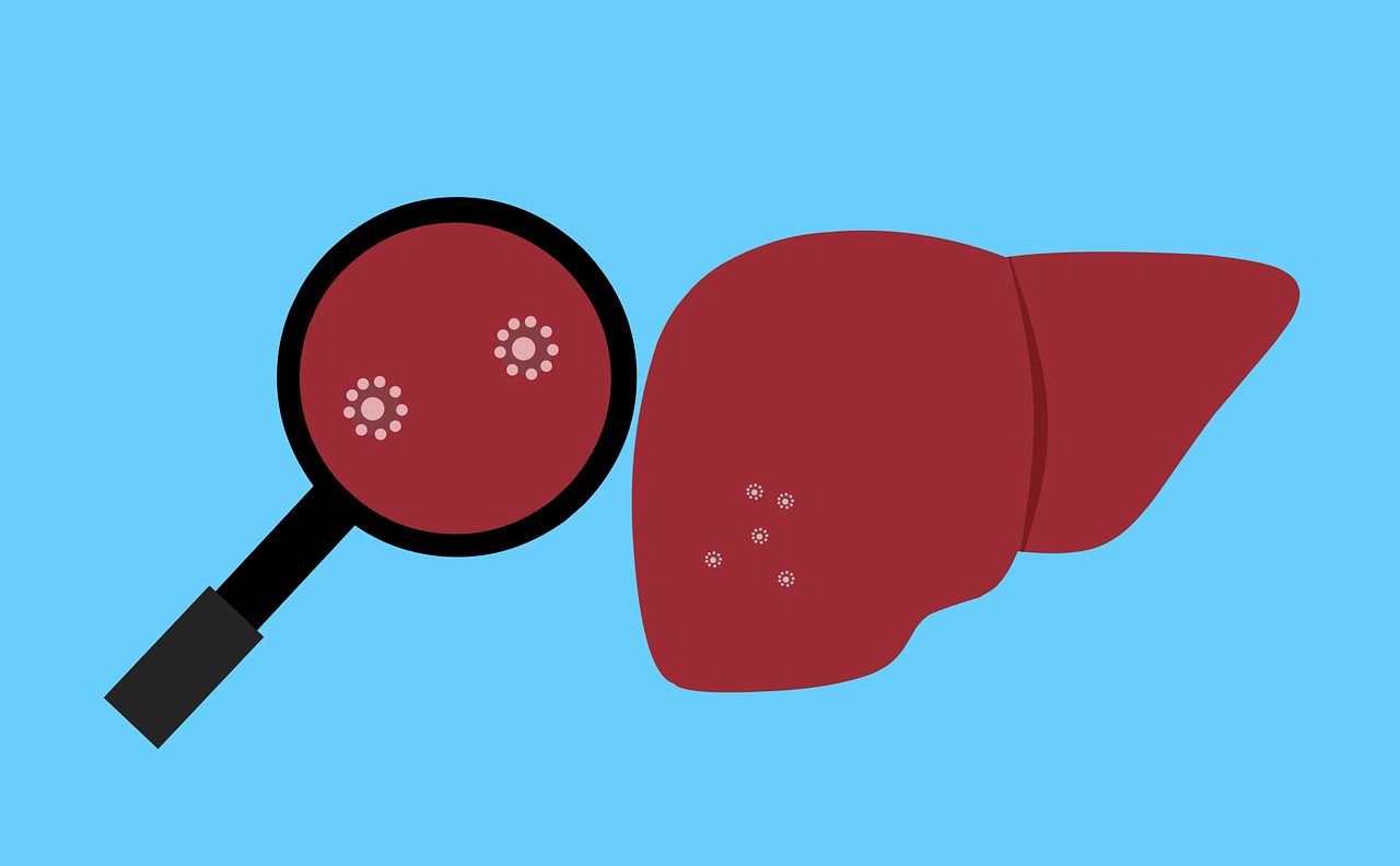  "간염(Hepatitis) 이해하기: 원인, 증상 및 예방 방법"