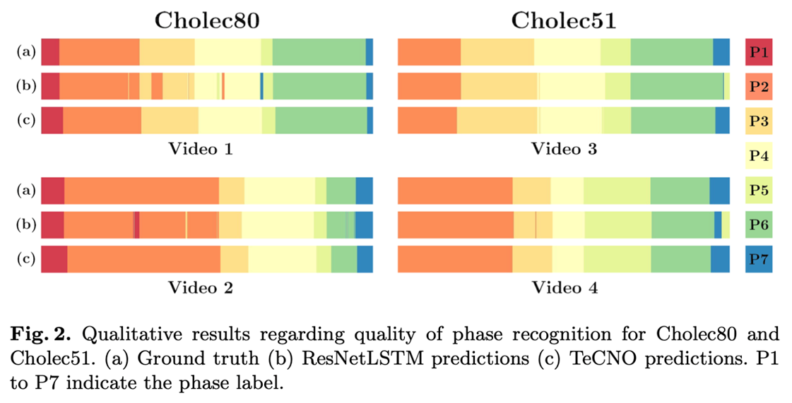 [paper review] (MICCAI, 2020) TeCNO: Surgical Phase Recognition with ...