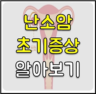 난소암 증상 1