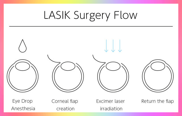 라식 수술