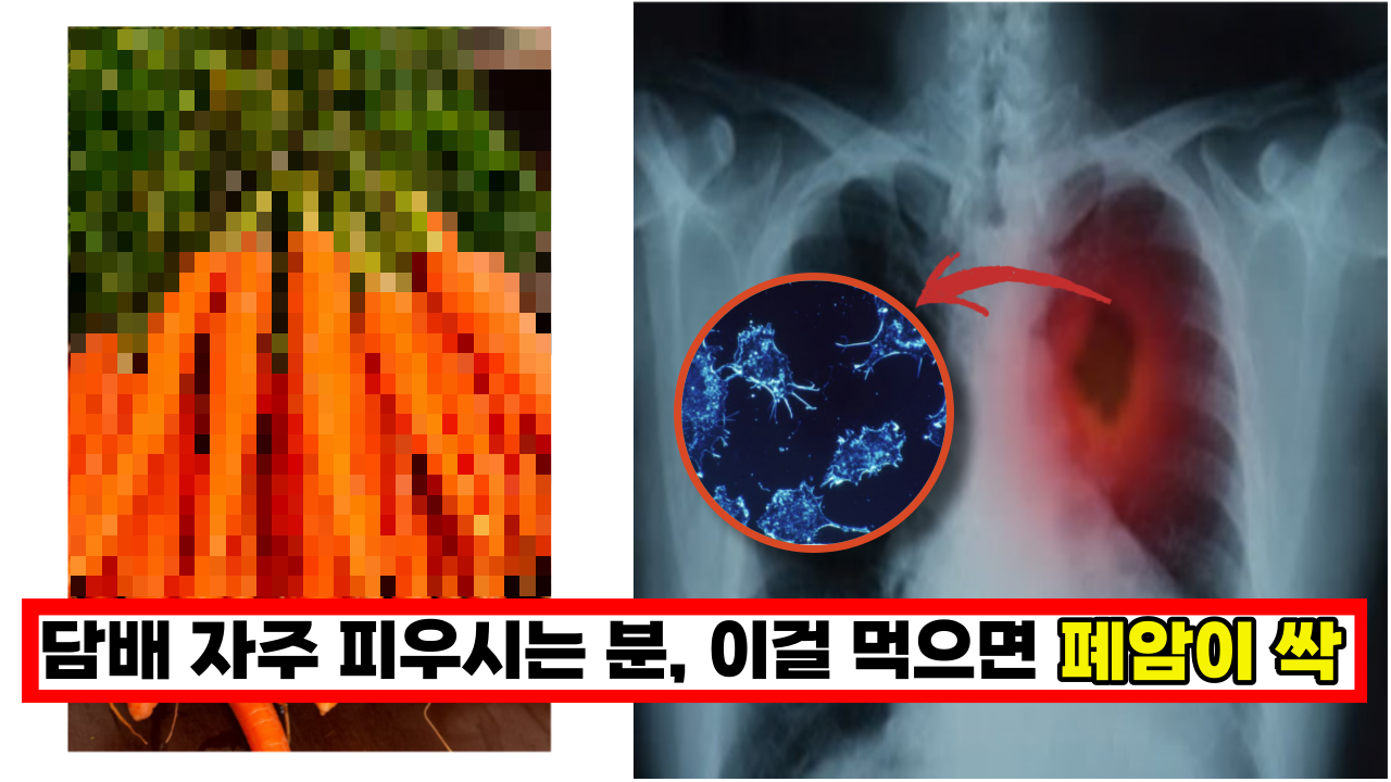  '담배 중독이라면 꼭 이렇게 드세요'  폐렴 예방에 면역력을 300% 높여 주는 이 음식