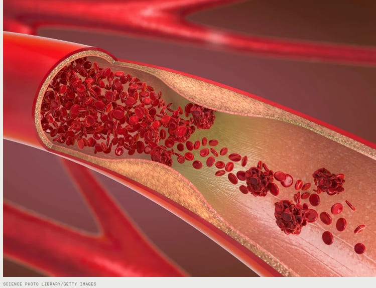 혈관 진입 미니 로봇&#44; 수술 완료!(한양대팀) VIDEO: Small Magnetic Robot Completes Vascular Surgery