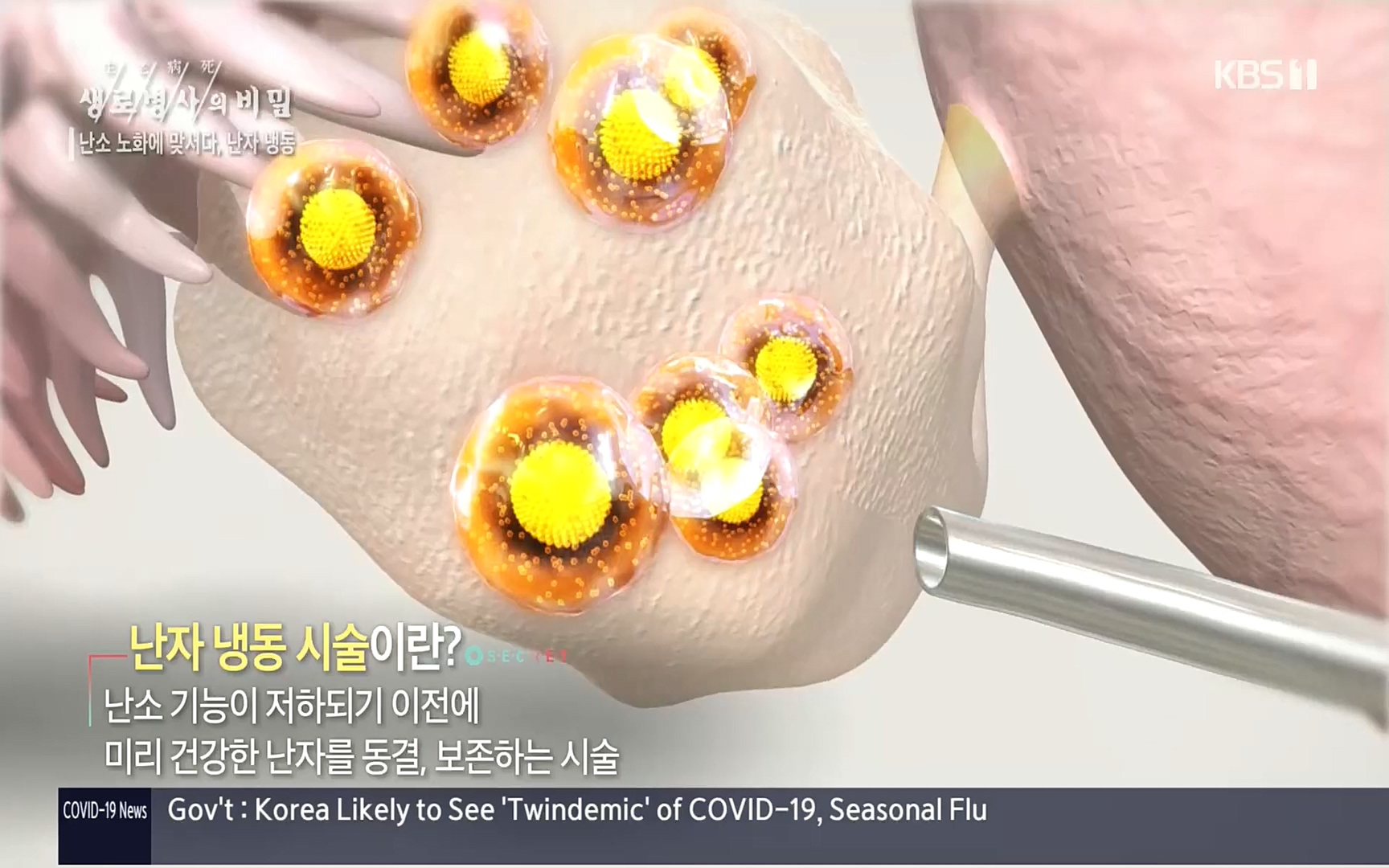 생로병사의 비밀.E836.220921p.H264-F1RST.mp4_20220925_180757.910.jpg