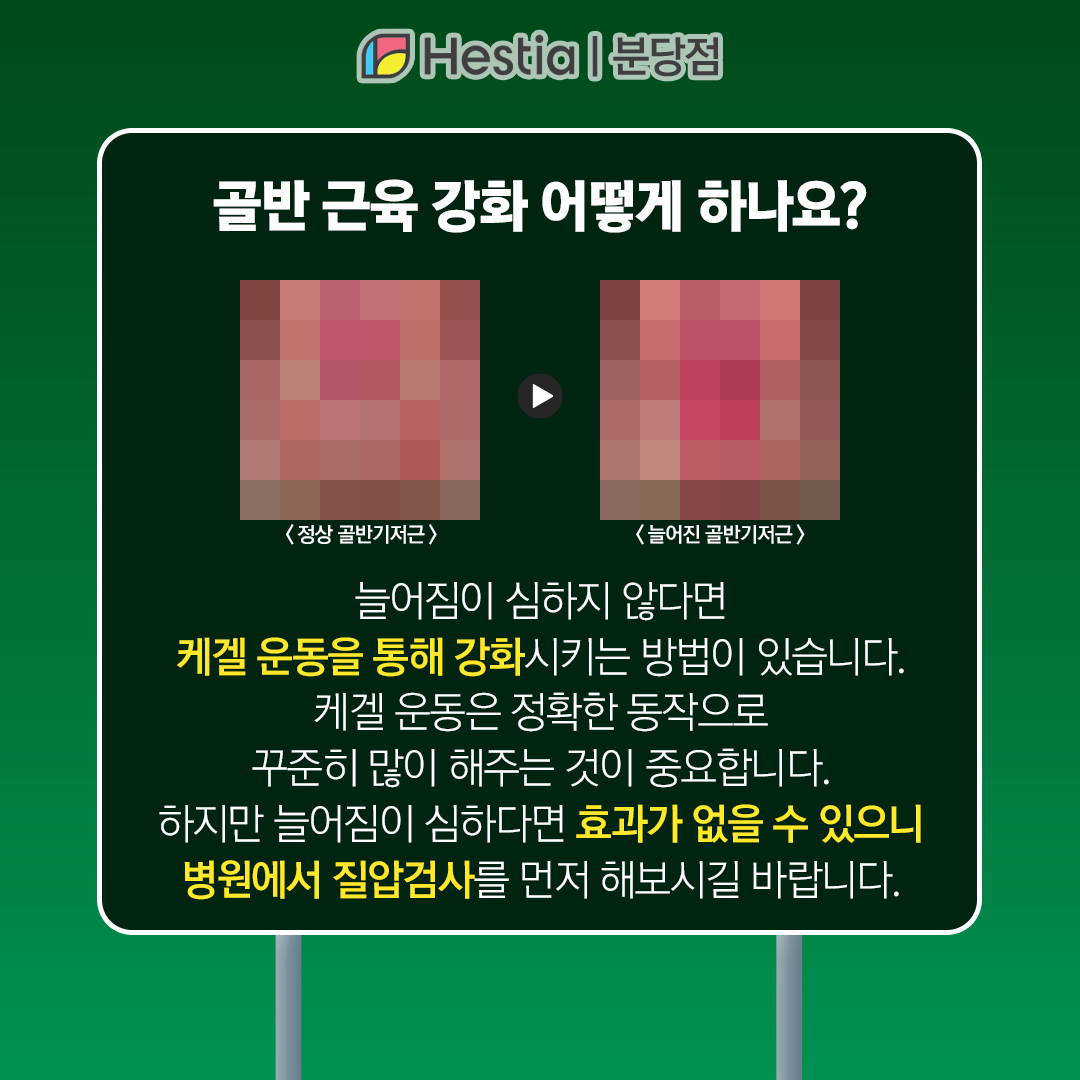 요가 질방귀 골반 근육 강화 분당산부인과 여의사 골반 근육 강화 방법이란?