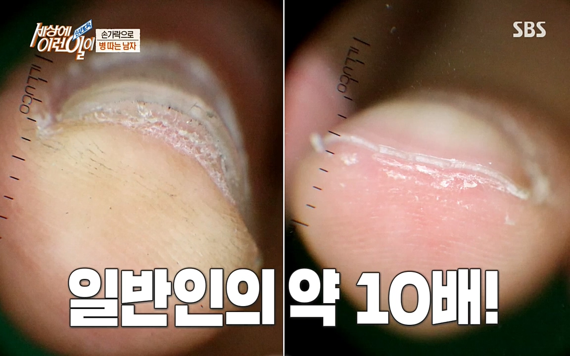 순간포착 세상에 이런일이.E1185.220622p-NEXT.mp4_20220622_201145.262.jpg