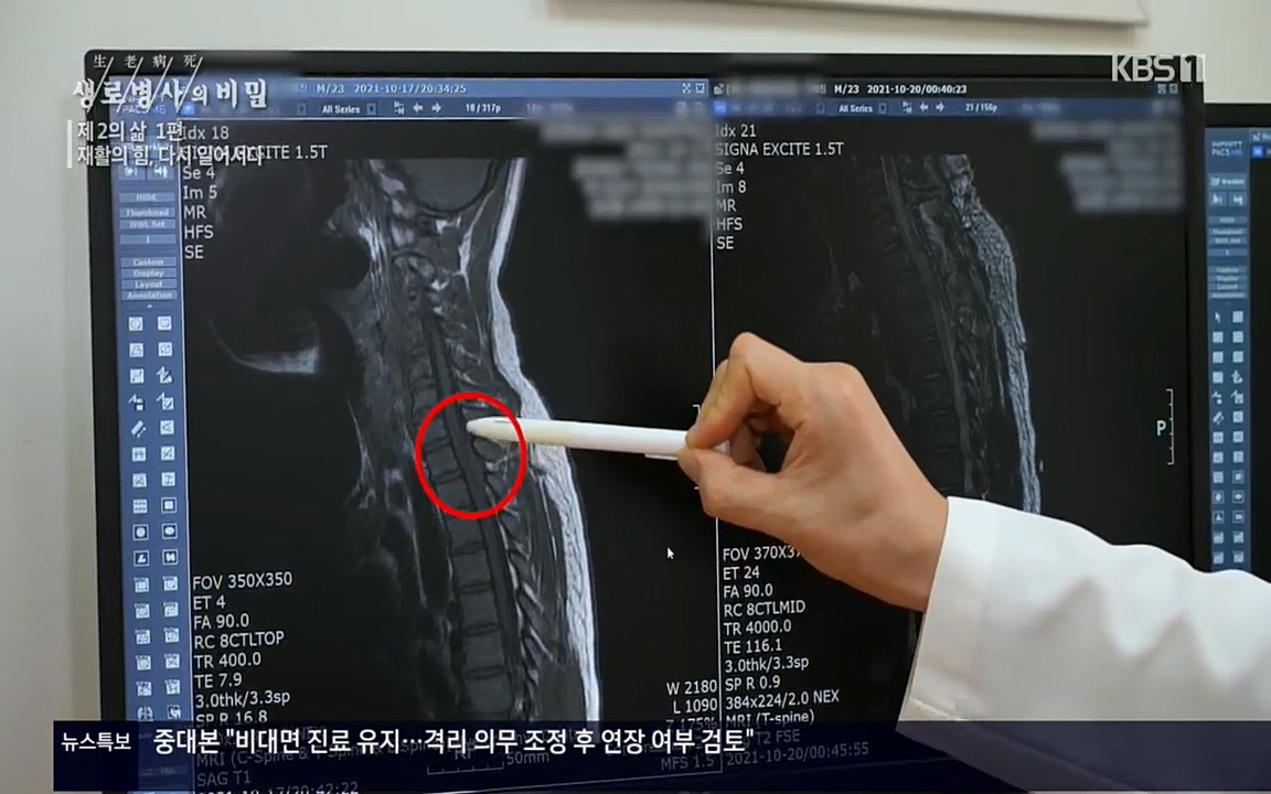 생로병사의 비밀.E819.220505p.H264-F1RST.mp4_20220508_182238.380.jpg