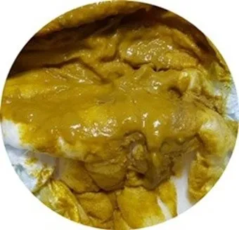 배가 부글부글 설사 원인파악 대처법_10