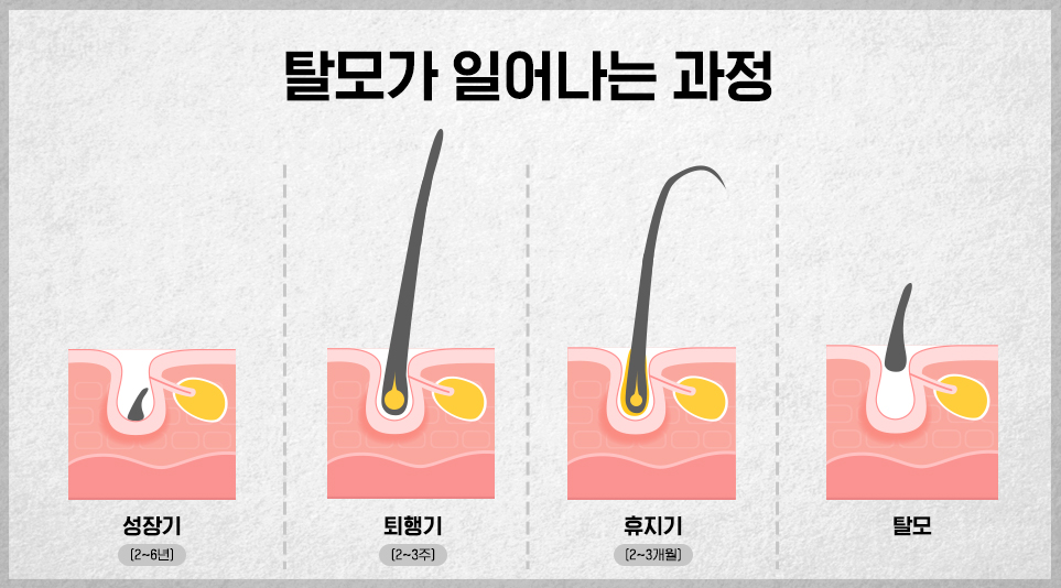 정상적인 탈모의 과정