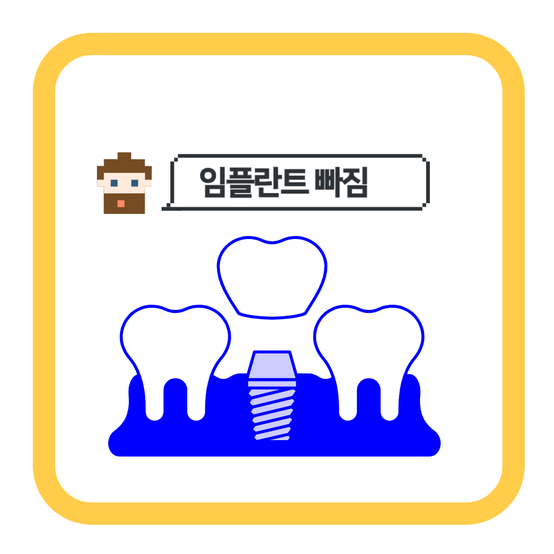  임플란트 크라운 빠짐의 원인과 주의사항