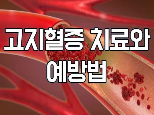  고지혈증 치료와 예방법(feat.콜레스테롤 관리)