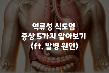 역류성 식도염 증상