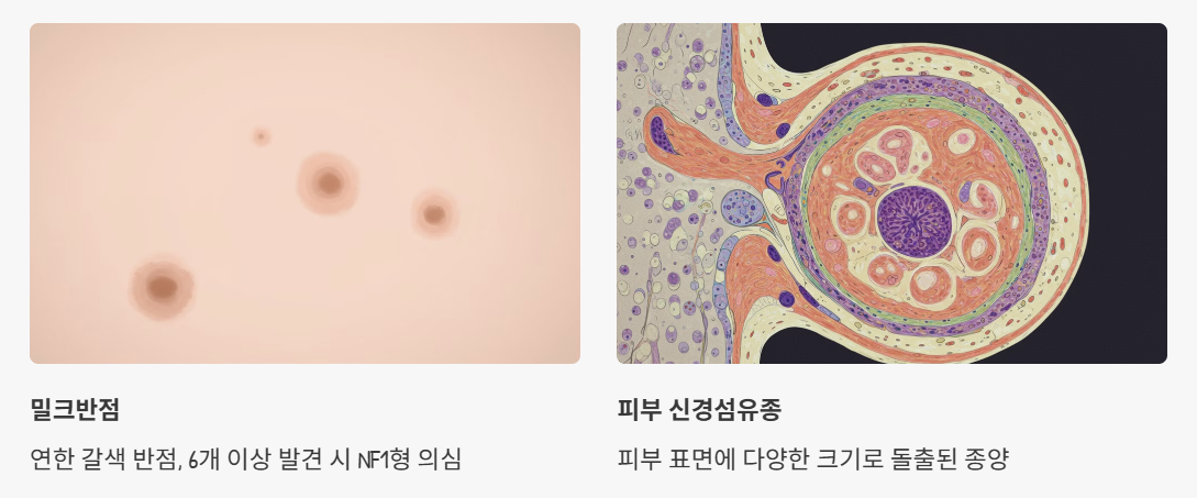 밀크반점, 피부 신경섬유종