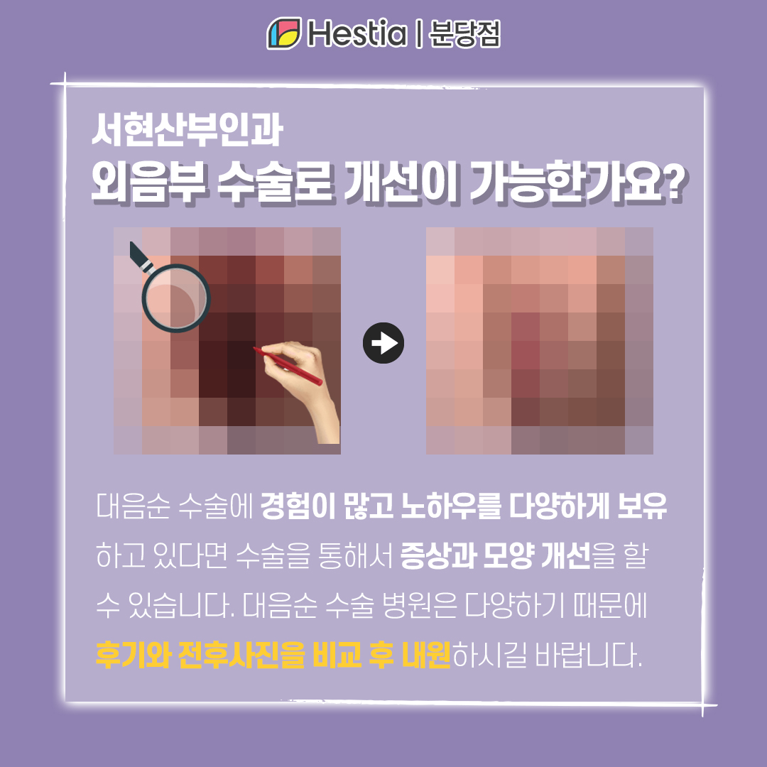 서현산부인과 대음순 늘어짐 외음부 수술 외음부 수술로 개선하는 법