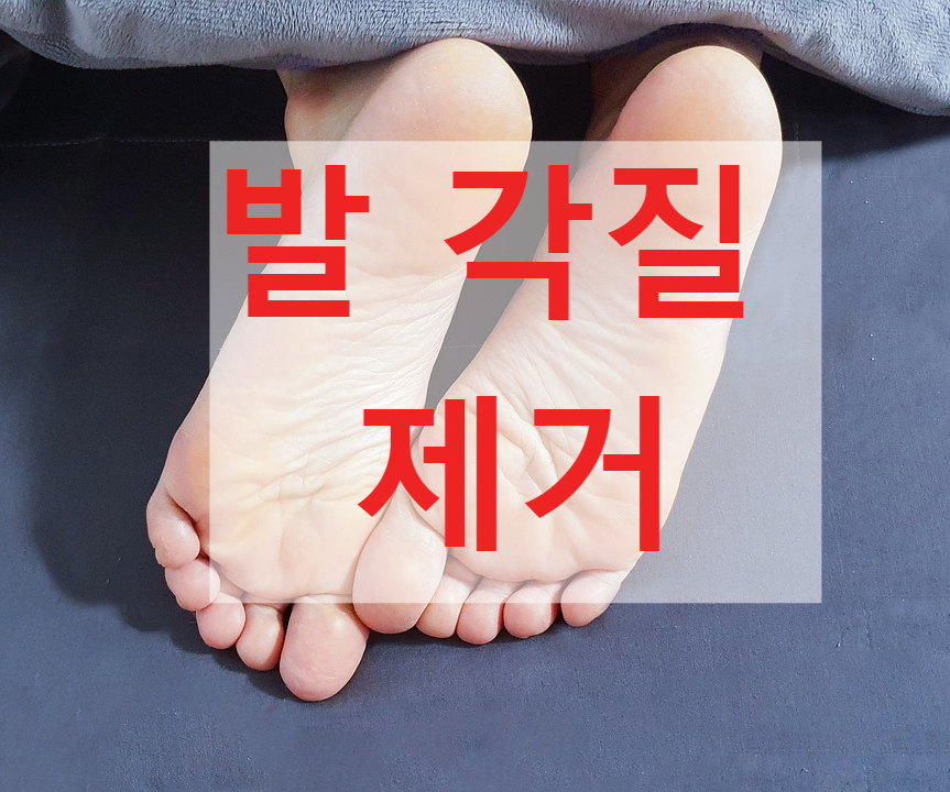 발 각질 제거