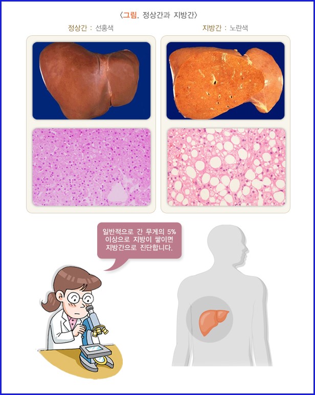 간 건강을 위한 7가지 식사 규칙