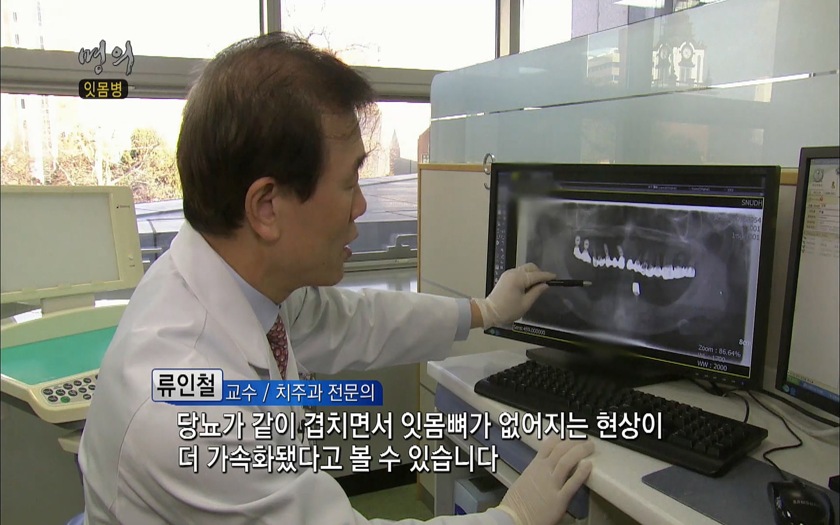 EBS 명의 헬스케어 - TV - 교육의 중심 EBS2015년 1월 16일 (금) 밤 9시 50분, EBS1.mp4_20220505_145503.375.jpg