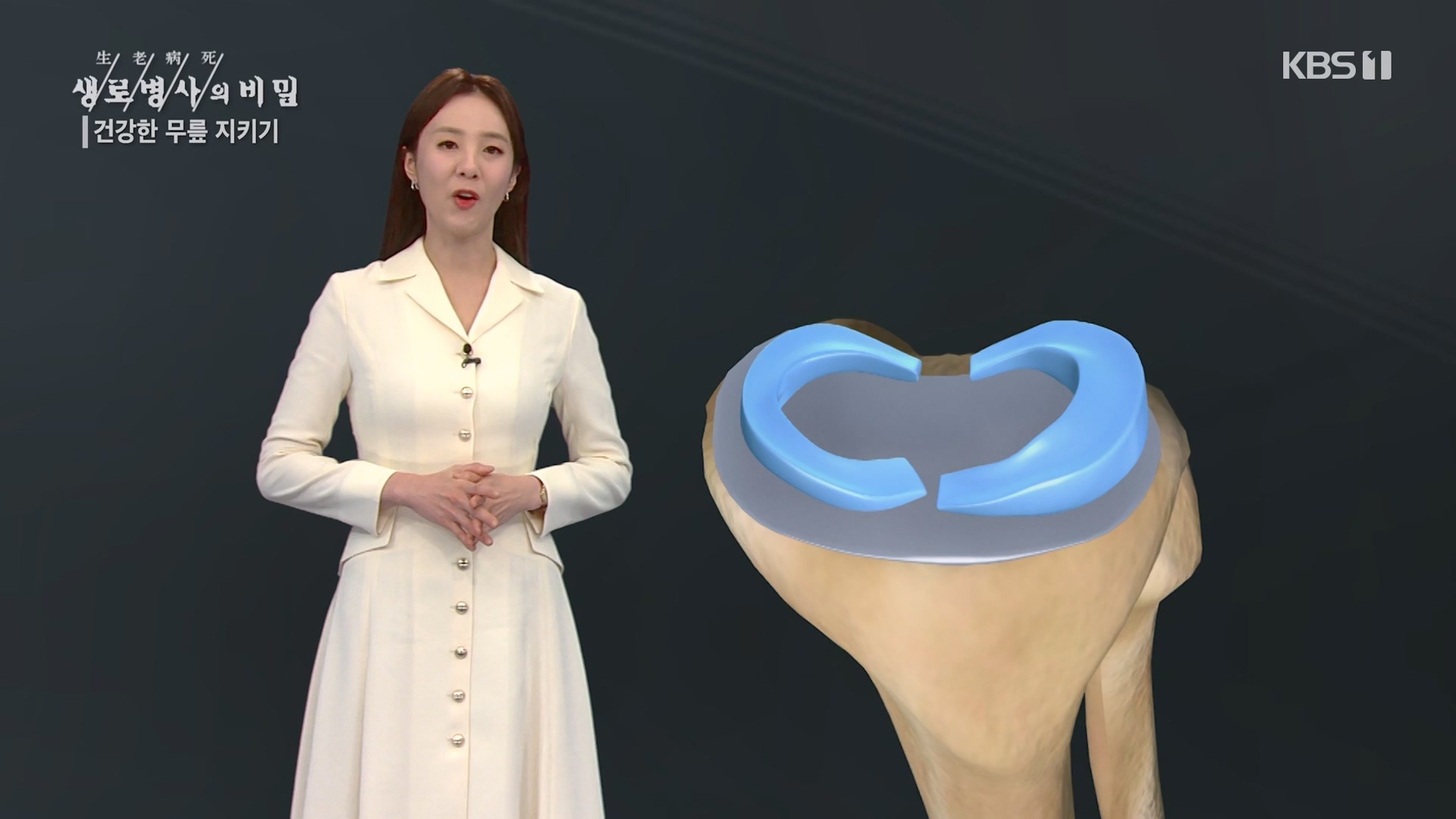 생로병사의 비밀.E873.230607p-NEXT.mp4_20230608_202207.546.jpg