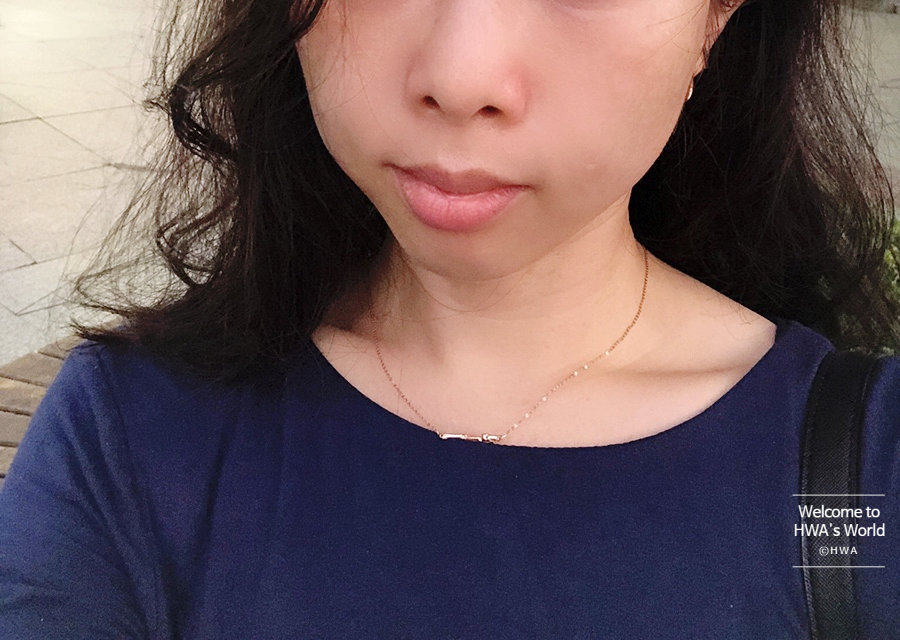 콧볼 축소 비용 [강남/보톡스] 콧볼축소주사-후기 6