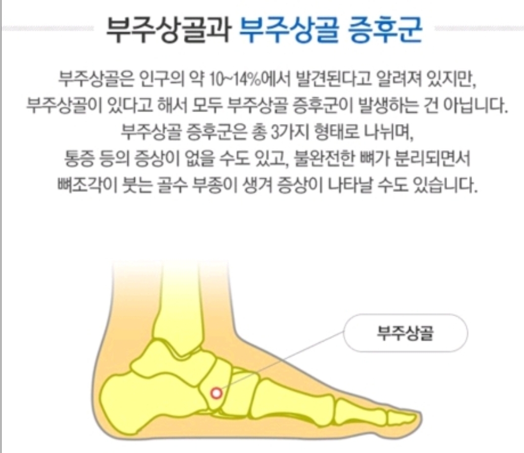 부주상골