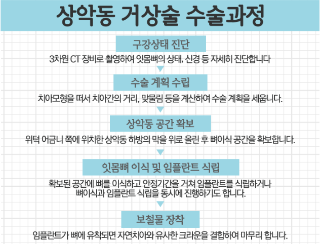 에스프라임 이미지