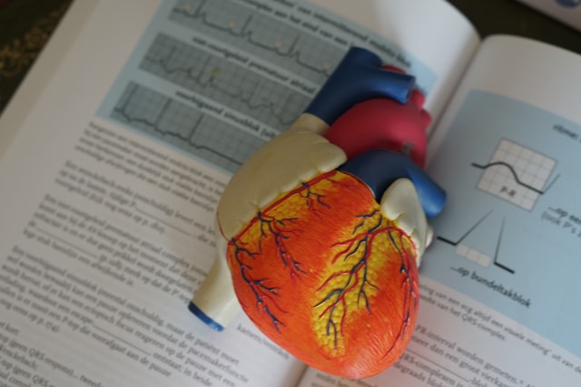 심박수-서맥-빈맥-심방세동